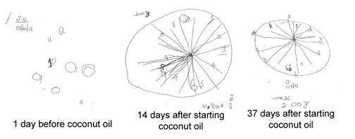Coconut Oil Clock Draw